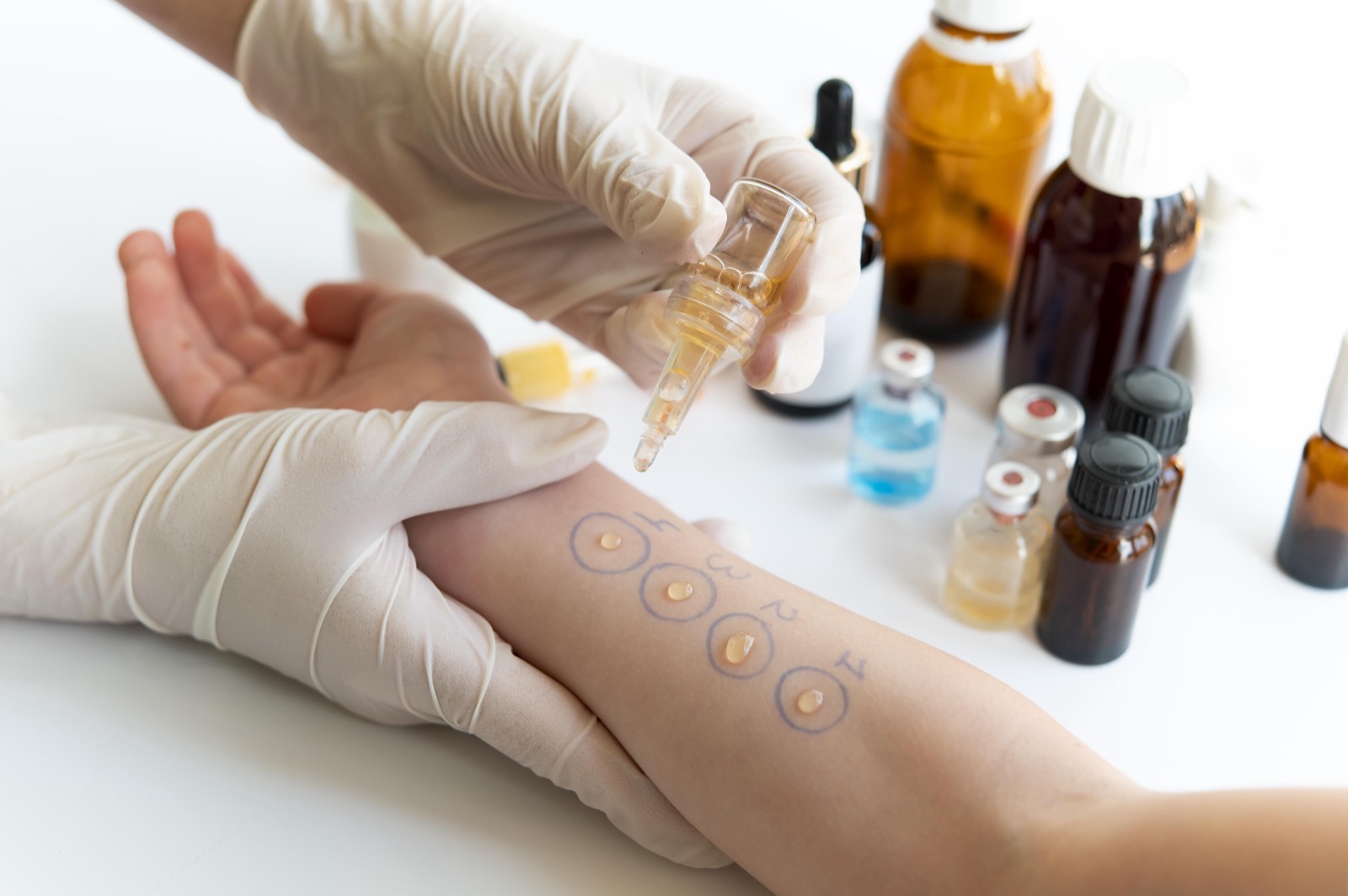 Allergy Care